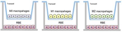 M2 macrophage inhibits the antitumor effects of Lenvatinib on intrahepatic cholangiocarcinoma